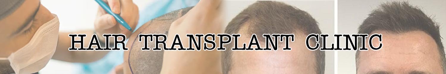 Hair Transplant Clinic